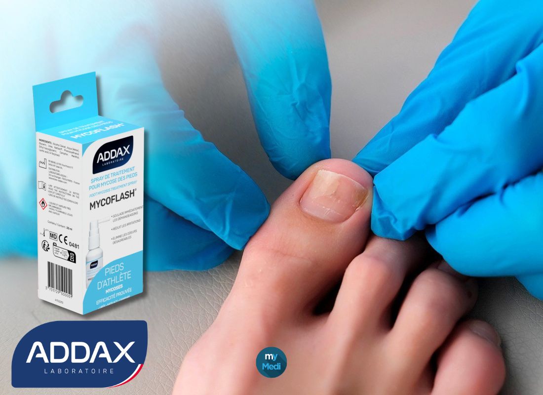 Mycoses des ongles : Laboratoire Addax, les gagnants selon ALLOPODO !