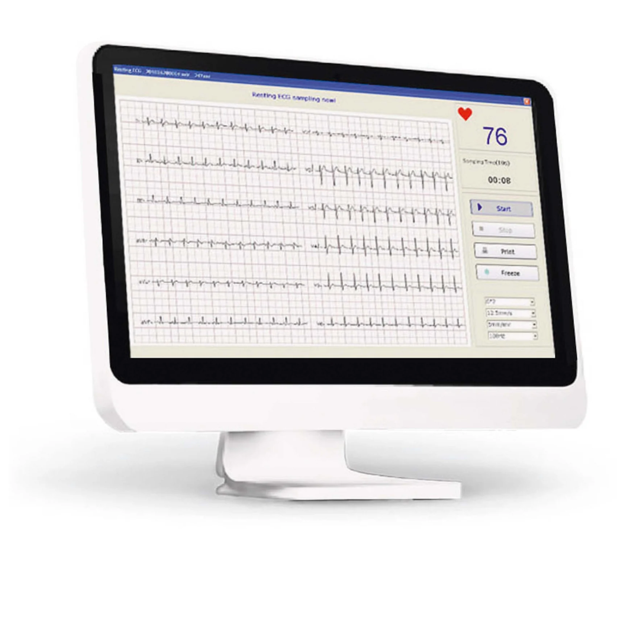 Digital ECG PC SE-1010 - EDAN