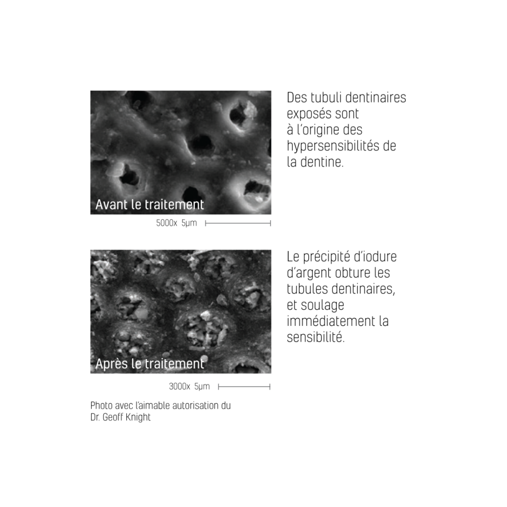 Désensibilisant dentaire Riva Star - flacons/kit capsules - SDI - My Médical