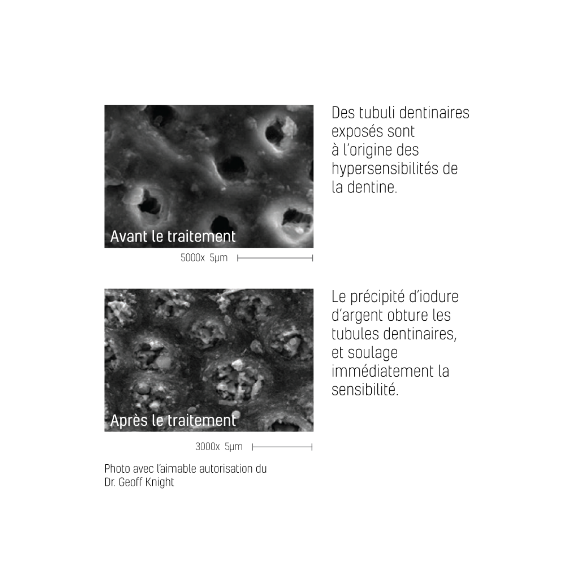 Désensibilisant dentaire Riva Star - flacons/kit capsules - SDI - My Médical