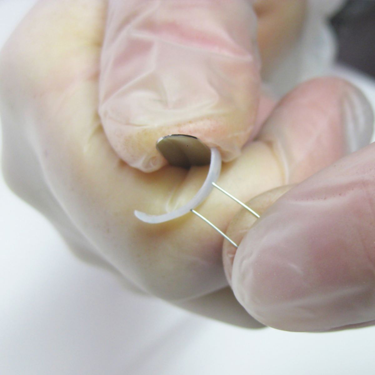Languettes d’orthonyxie pour ongles incarnés et déformés - Différentes tailles - Podofix - My Médical