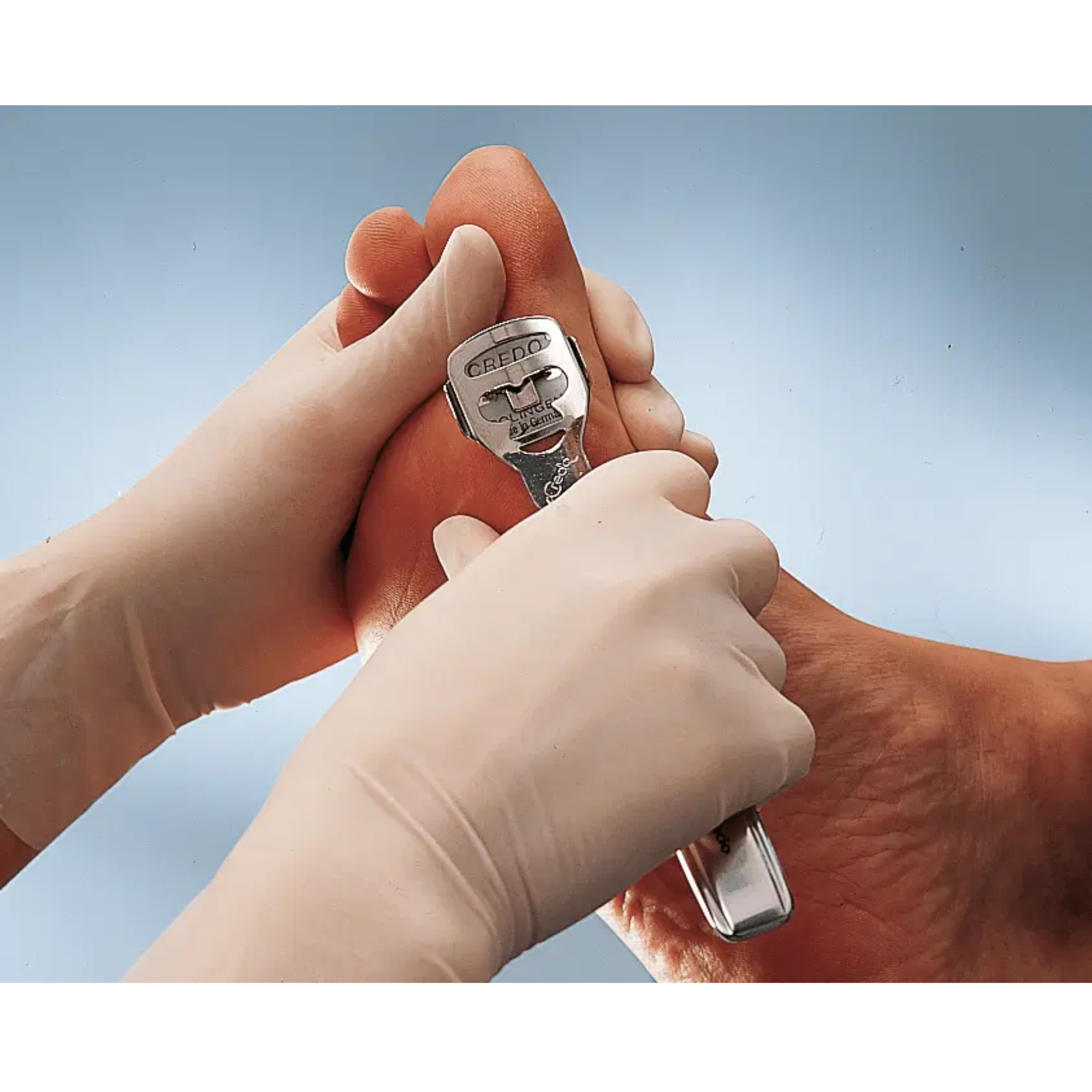 Stainless Steel Callus Planer with Rasp Adapter - Credo