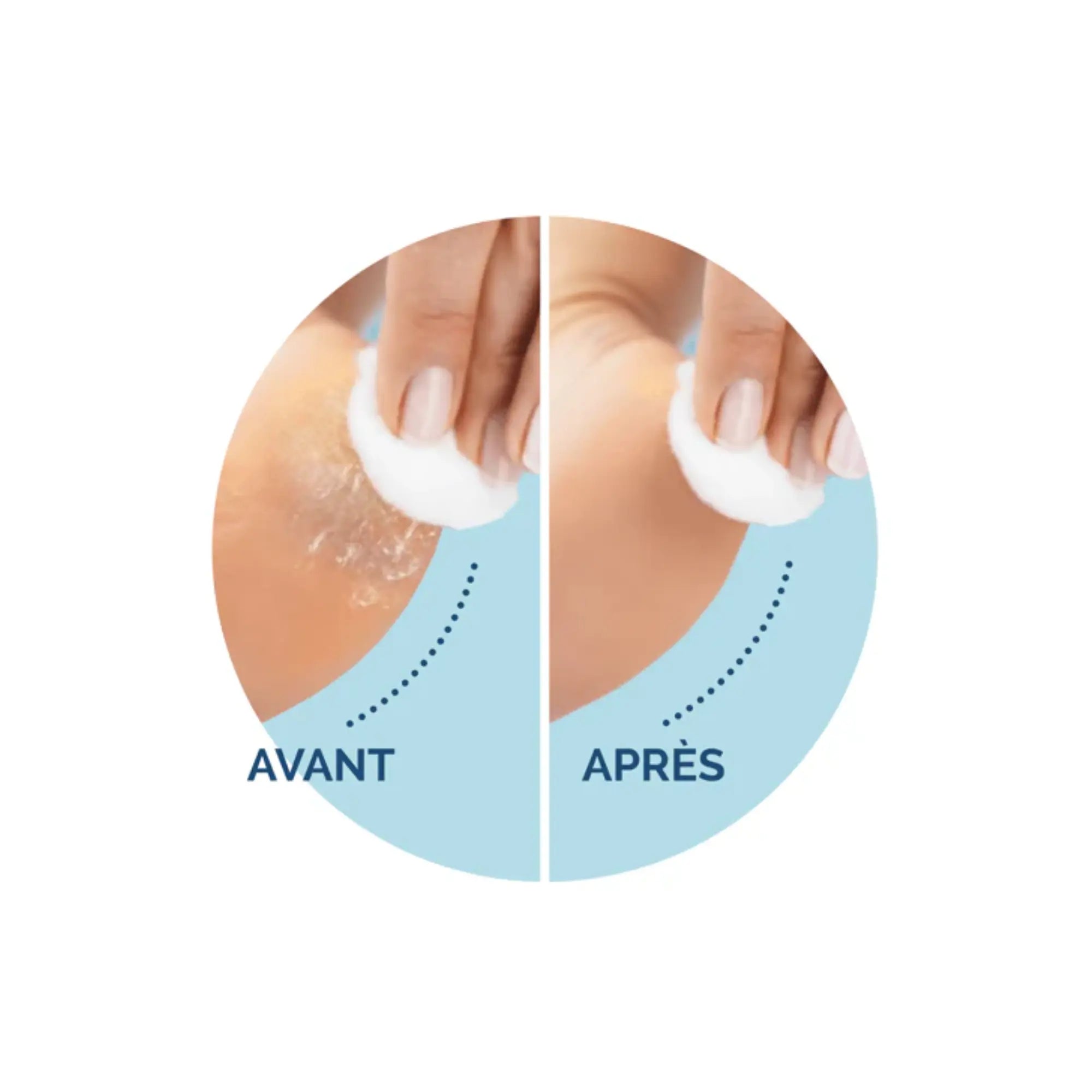 Recharge Rouleau Grain Ultra-Exfoliant - Râpe de Pédicurie Électrique - Velvet Smooth - Scholl - My Médical